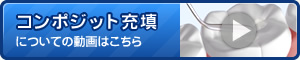 コンポジット充填についてに動画はこちら