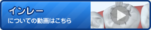インレーについてに動画はこちら