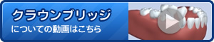 クラウンブリッジについてに動画はこちら