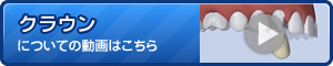 クラウンについてに動画はこちら