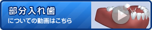 部分入れ歯についての動画はこちら