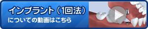 インプラント(1回法)についてに動画はこちら