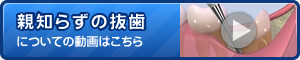 親知らずの抜歯についてに動画はこちら
