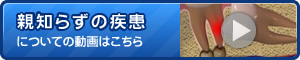 親知らずの疾患についてに動画はこちら