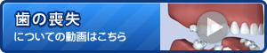 歯の喪失についてに動画はこちら