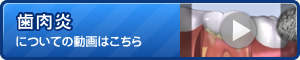 歯肉炎についてに動画はこちら