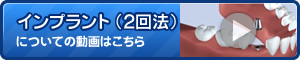 インプラント(2回法)についてに動画はこちら