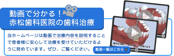 動画で分かる！赤松歯科医院の歯科治療